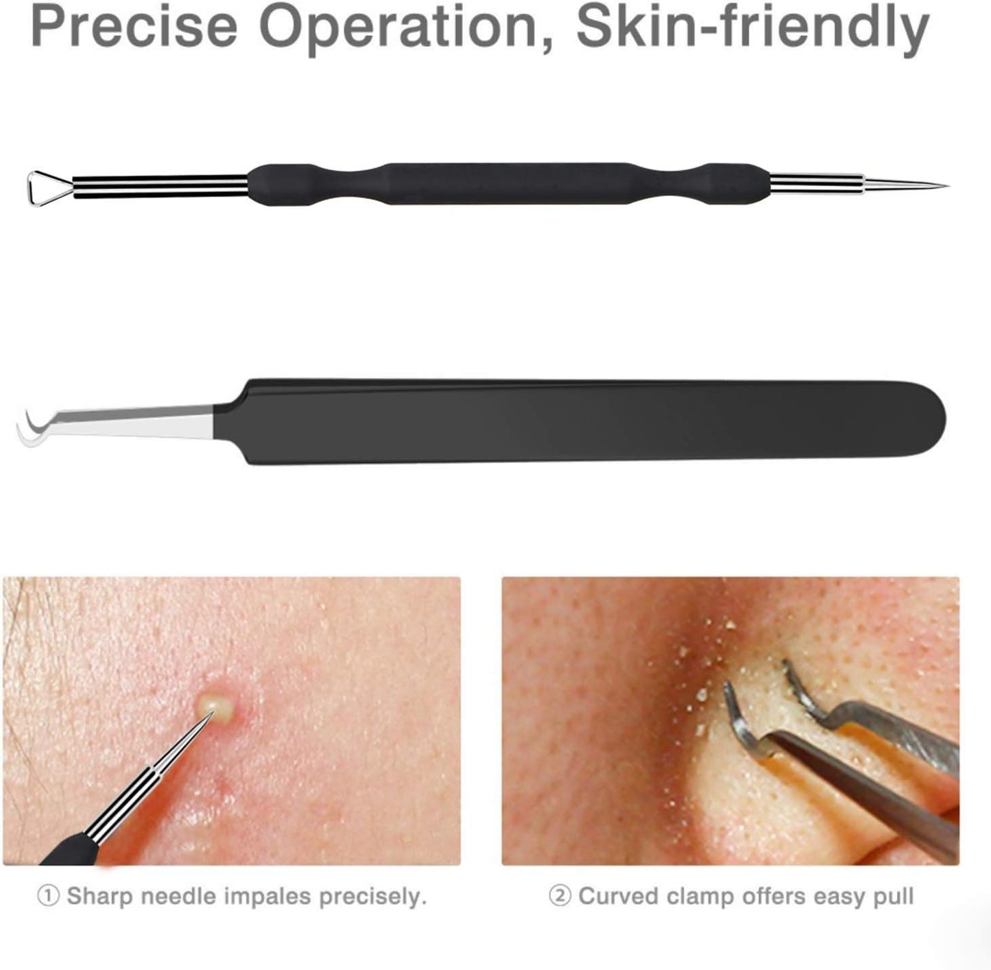 6-Piece Blackhead & Acne Removal Kit – Comedone Extractor Tools with Black Leather Bag