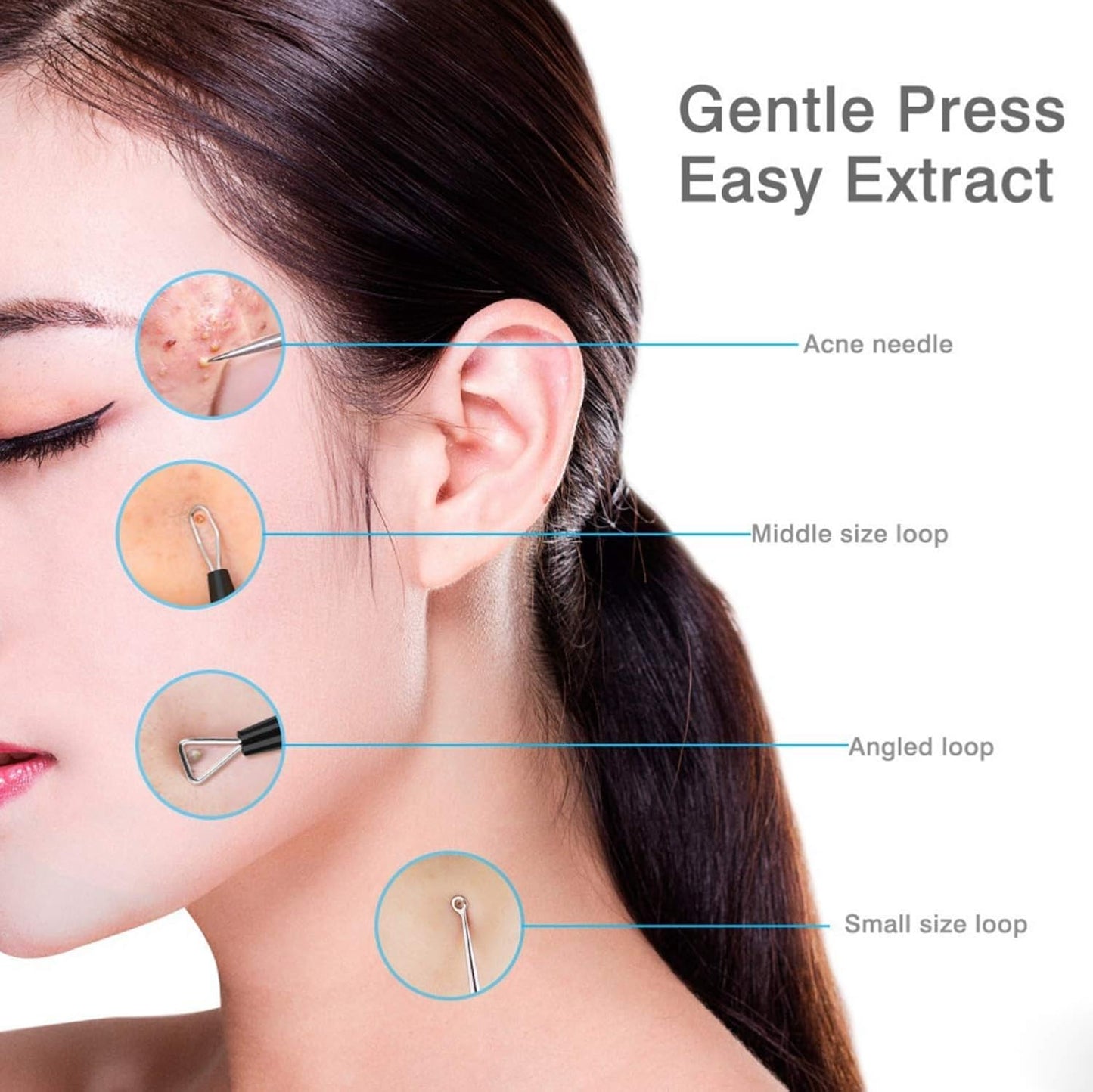 6-Piece Blackhead & Acne Removal Kit – Comedone Extractor Tools with Black Leather Bag