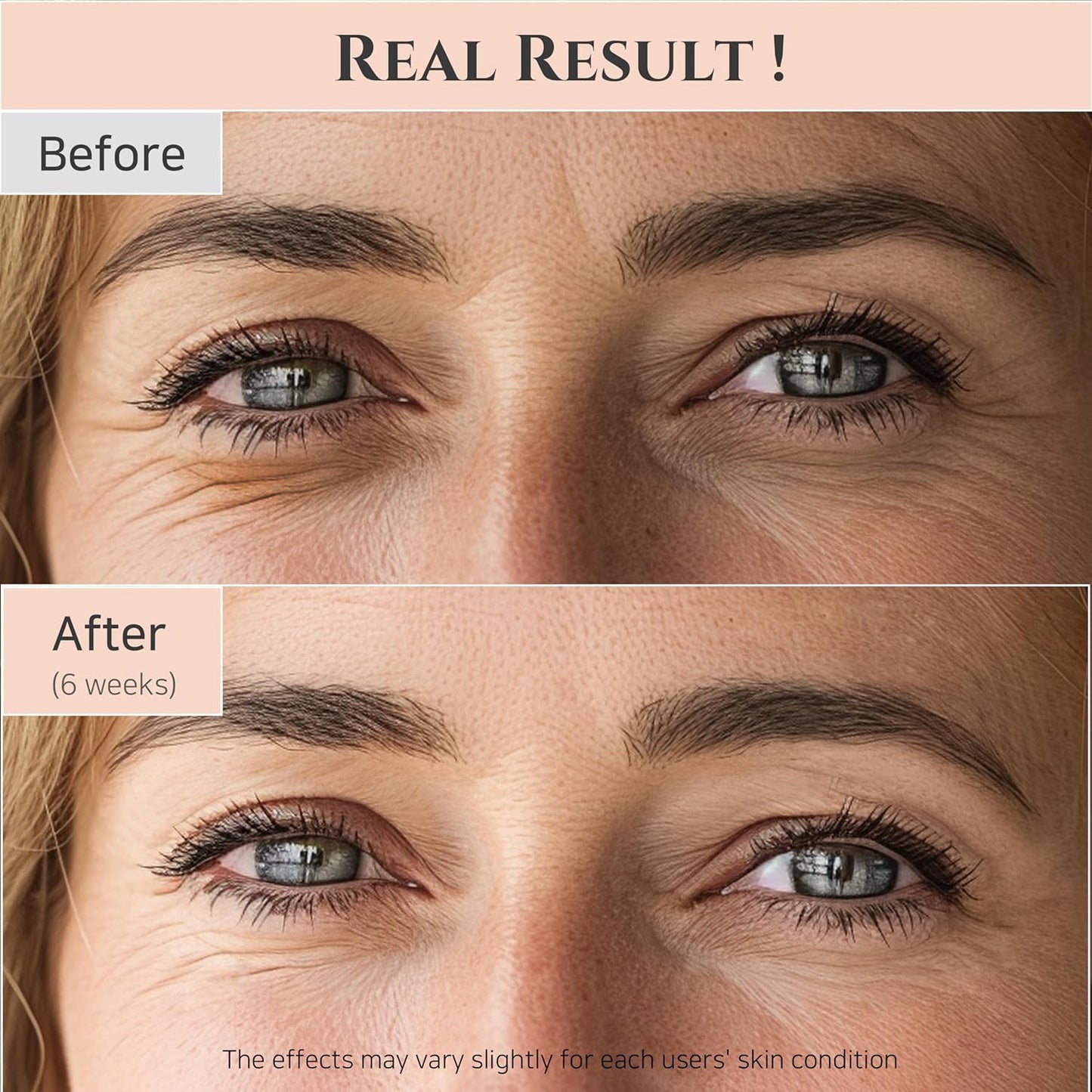 Revive Eye Serum - Retinal & Niacinamide for Puffiness, Dark Circles, Wrinkles (30ml)