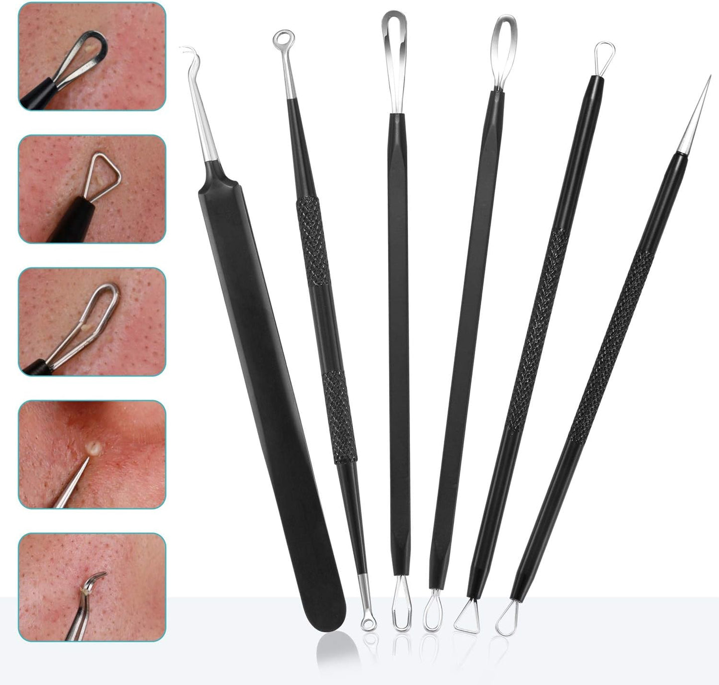 6x Professional Stainless Steel Comedone Extractor Tools for Blackhead and Pimple Removal