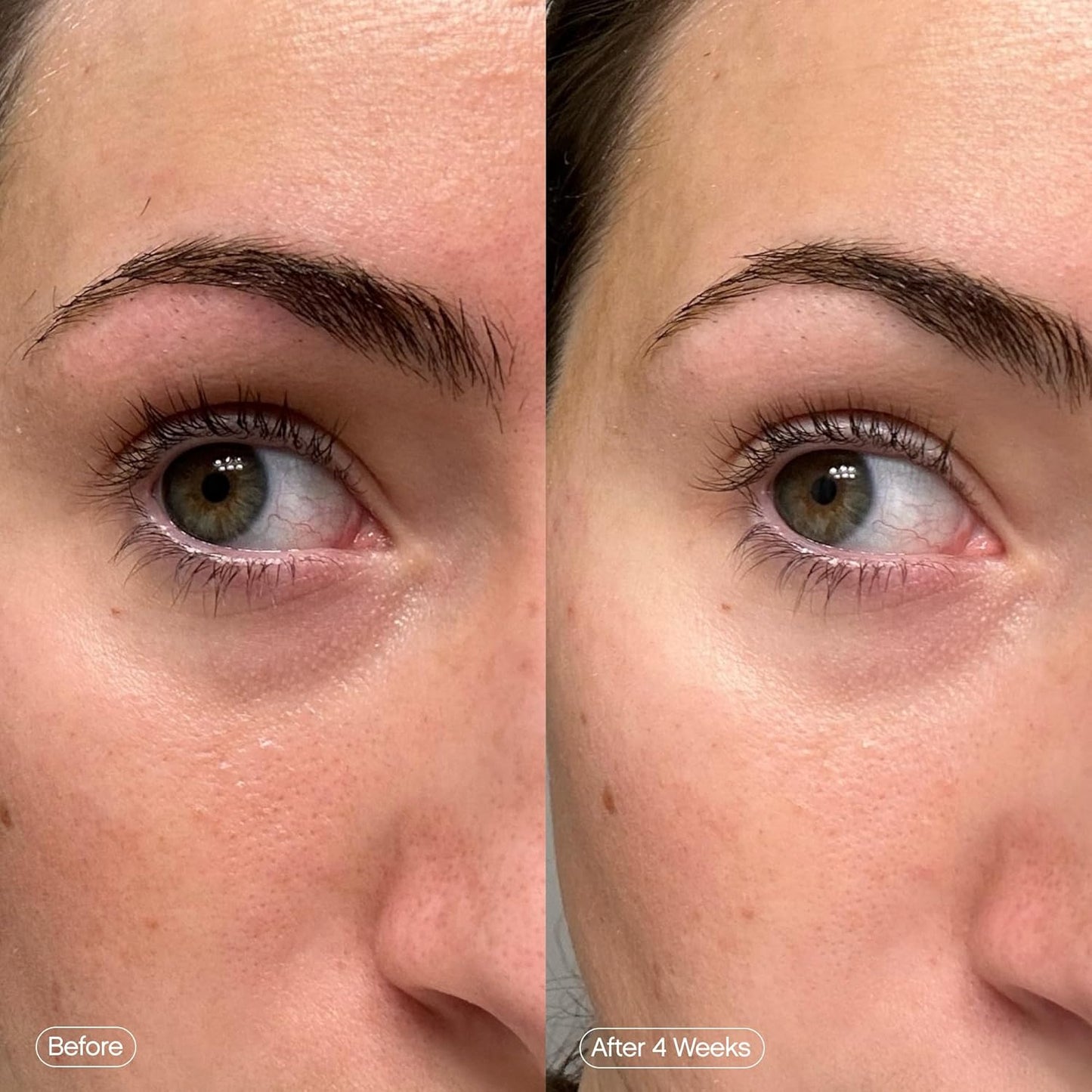 Brightening Under Eye Masks – Depuff, Hydrate & Illuminate with Kojic Acid & Caffeine